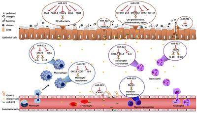 miR-223: A Key Regulator in the Innate Immune Response in Asthma and COPD